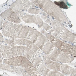 anti-TMEM176A, Polyclonal, Novus Biologicals 0.1mL; Unlabeled:Antibodies,